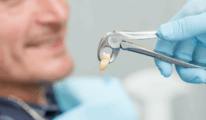 Preparing for tooth extraction checklist and guidance from Global Dental Dentist professionals