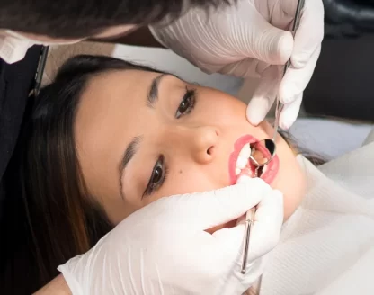 Protect-Your-Teeth-with-Long-Lasting-Dental-Sealants-in-Brampton 